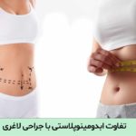 تفاوت ابدومینوپلاستی با جراحی لاغری