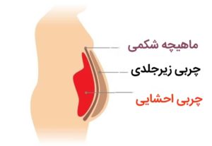 لاغری پهلو، چربی احشایی