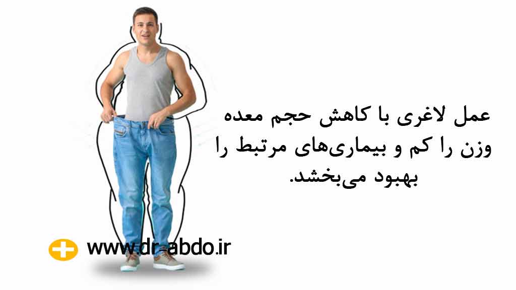 عمل لاغری چیست؟
