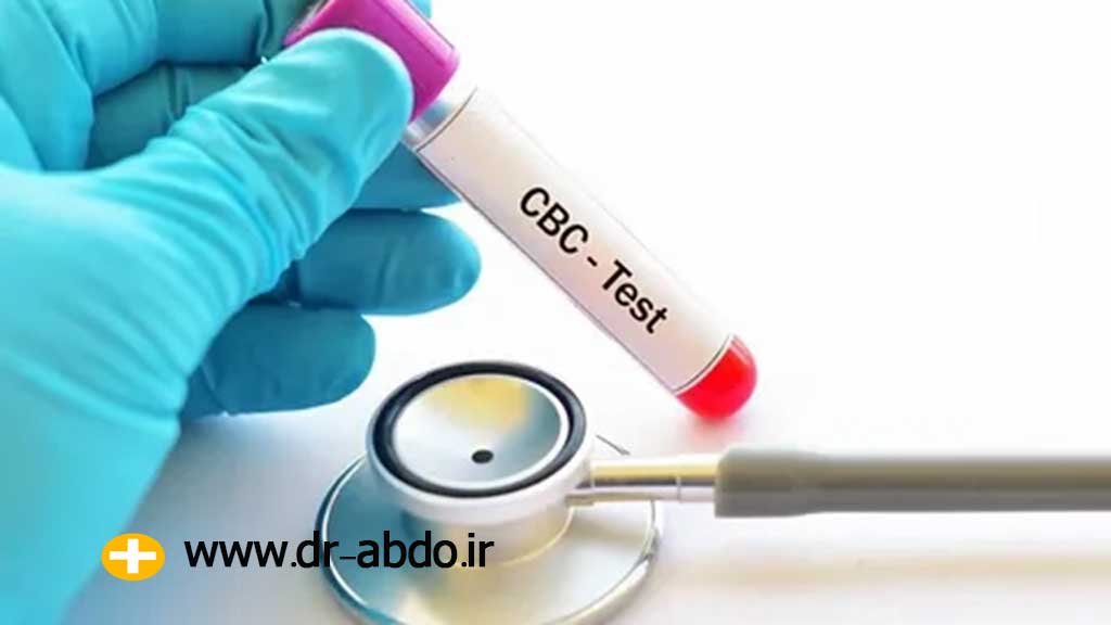 آزمایش-CBC