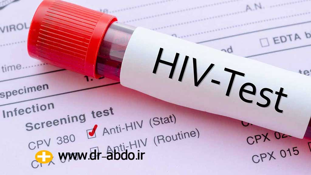 آزمایش HIV