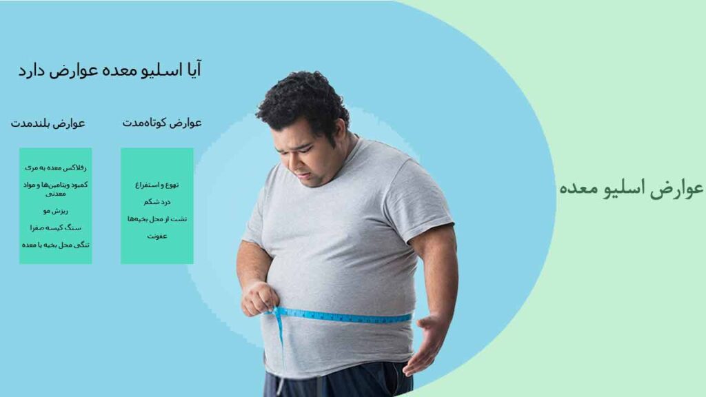 عوارض اسلیو معده