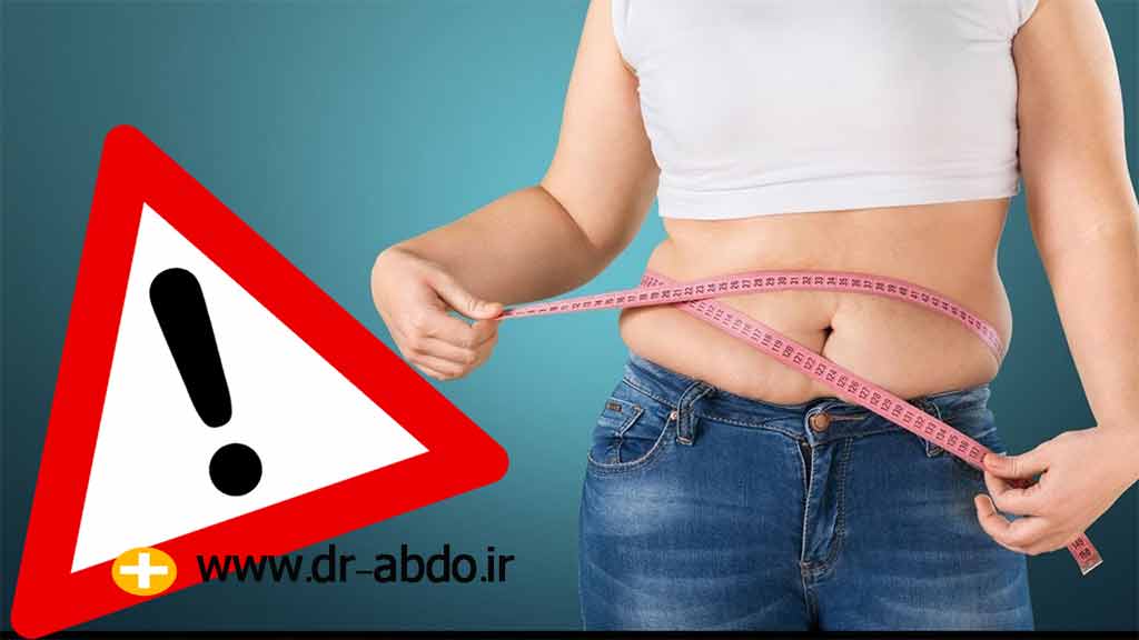  اسلیو معده چه عوارضی دارد؟