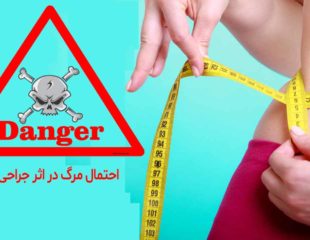 احتمال مرگ در اثر جراحی لاغری