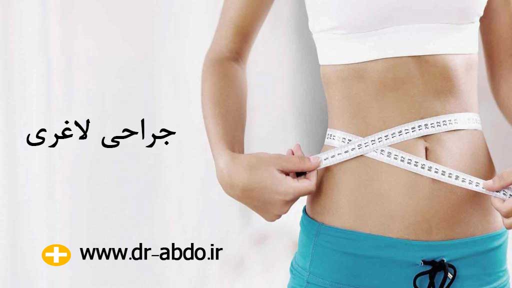 جراحی بای پس معده