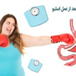 دلایل استپ وزن بعد از عمل اسلیو