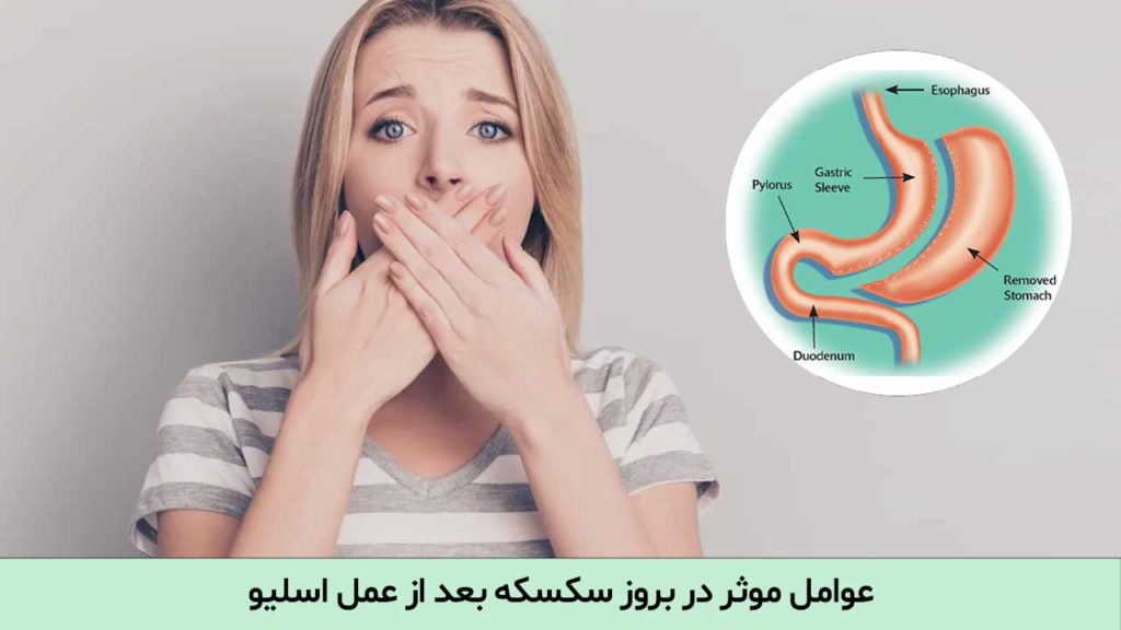 سکسکه بعد از عمل اسلیو