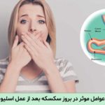 سکسکه بعد از عمل اسلیو