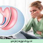 علت بروز حالت تهوع بعد از عمل اسلیو