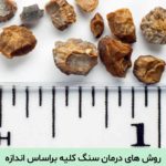 اندازه سنگ کلیه