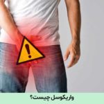 واریکوسل چیست؟