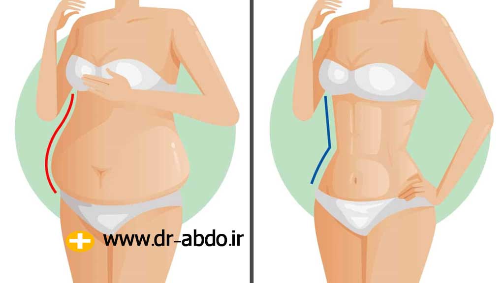 اتفاقات بعد از جراحی معده
