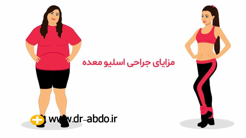 مزایای جراحی اسلیو معده