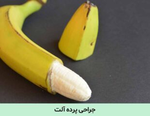 جراحی پرده آلت