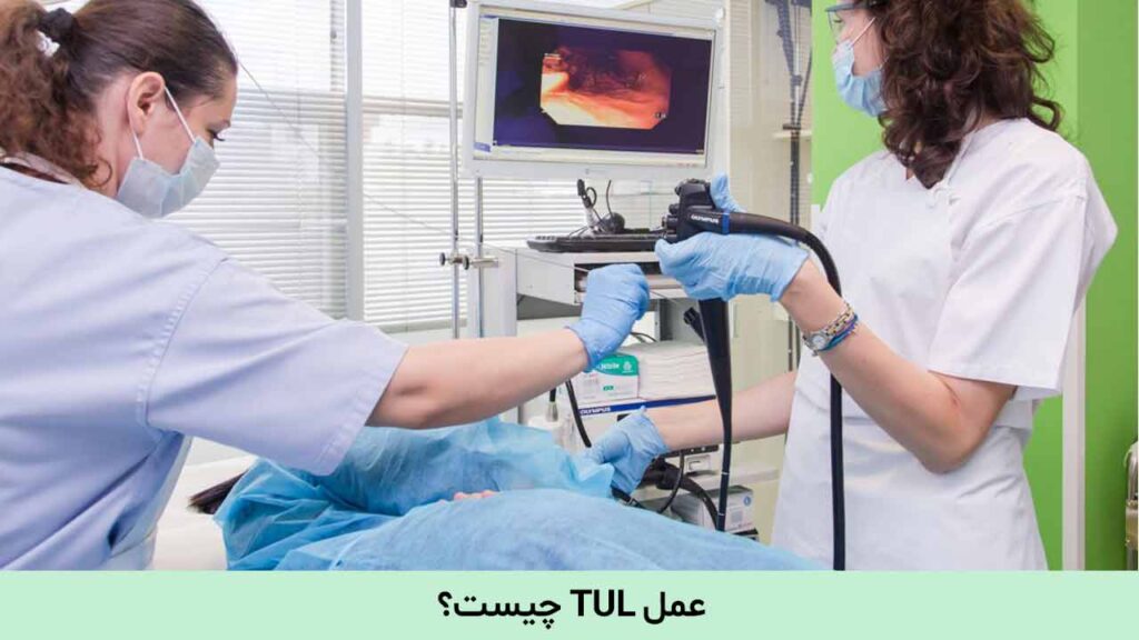 عمل TUL چیست؟