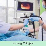 عمل TUL چیست؟