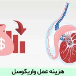 هزینه عمل واریکوسل
