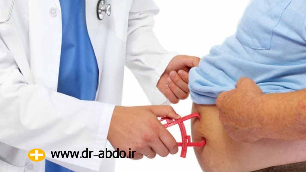 جراحی چاقی چیست؟