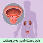 دلایل مبتلا شدن به پروستات