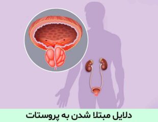 دلایل مبتلا شدن به پروستات