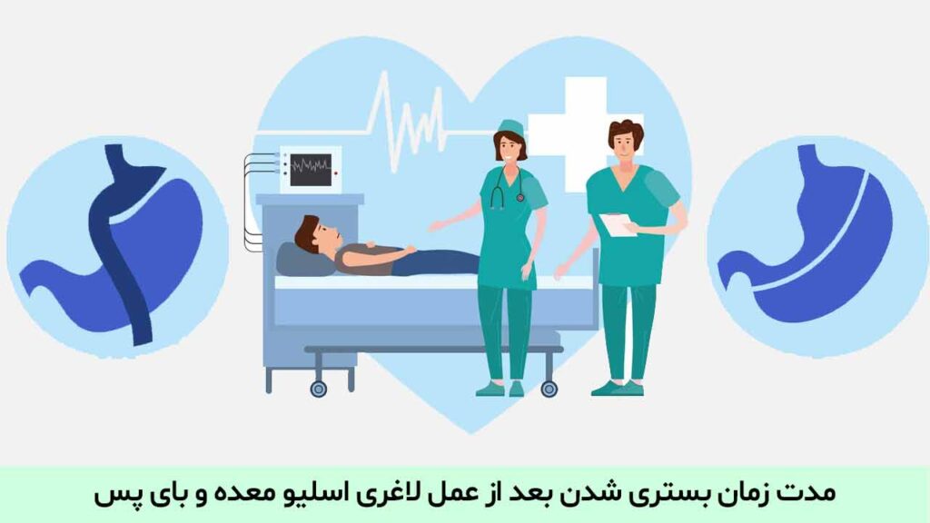 مدت زمان بستری شدن بعد از عمل لاغری اسلیو معده و بای پس