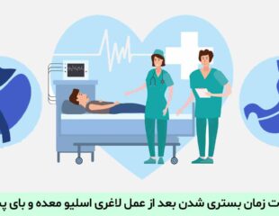 مدت زمان بستری شدن بعد از عمل لاغری اسلیو معده و بای پس