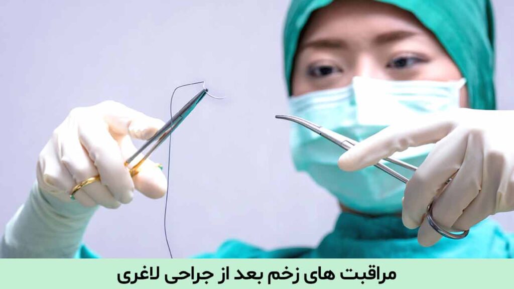 مراقبت های زخم بعد از جراحی لاغری