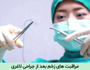 مراقبت های زخم بعد از جراحی لاغری