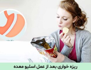 ریزه خواری بعد از عمل اسلیو معده