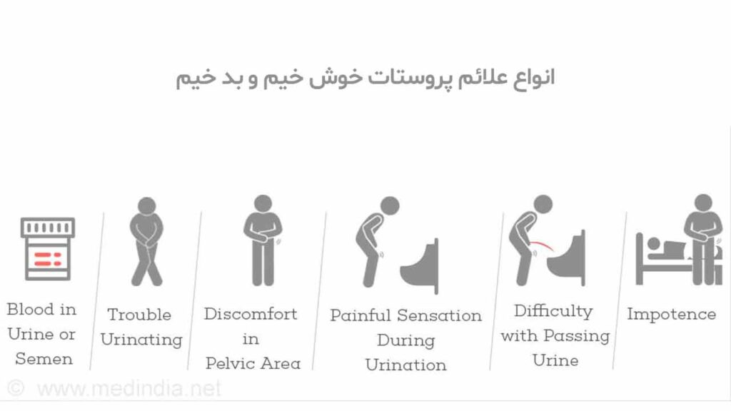 انواع علائم پروستات خوش خیم و بد خیم