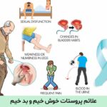 علائم پروستات خوش خیم و بد خیم