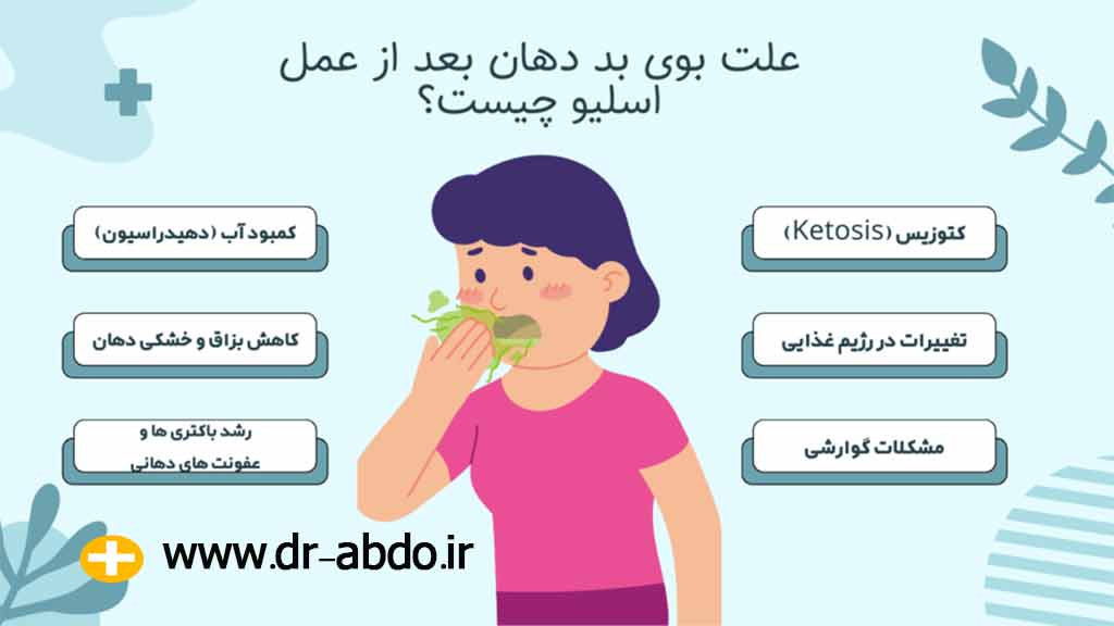 علت بوی بد دهان بعد از عمل اسلیو چیست؟