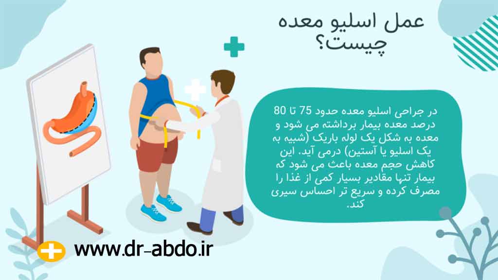 عمل اسلیو معده چیست؟